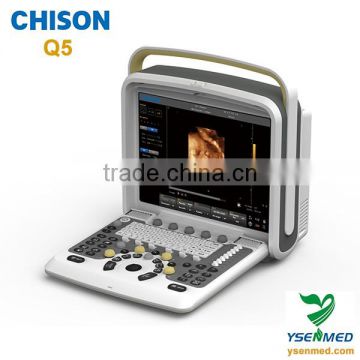 medical 4d portable color ultrasound Chison q5