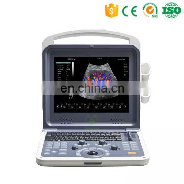 Newest MY-A025 Portable 4D Cardiac color doppler ultrasound scanner