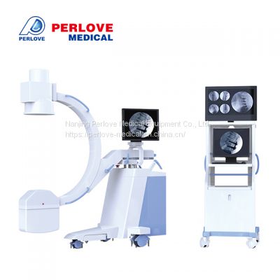 High Frequency Mobile C-arm System PLX112C1 200mA digital radiography systems