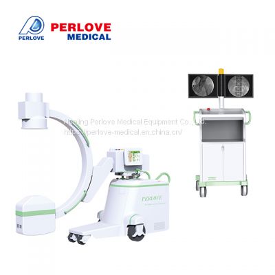 HF Mobile Digital C-arm System Flat Panel Detector PLX7000A Medical x ray fluoroscopy system