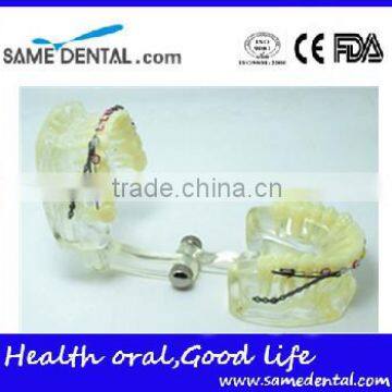 Dental Model Transparent orthodontic models Dental Eduction Assitant No. DEA-08