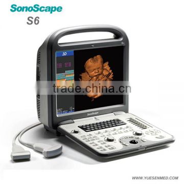 4D Portable color doppler ultrasound price