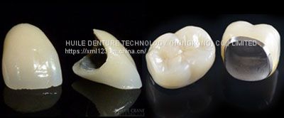 Dental Laboratory Zirconia Denture Teeth High Hardness CAD CAM Technology