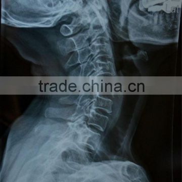 thermal ct films sale from x ray manufacturer xray knd-a/f