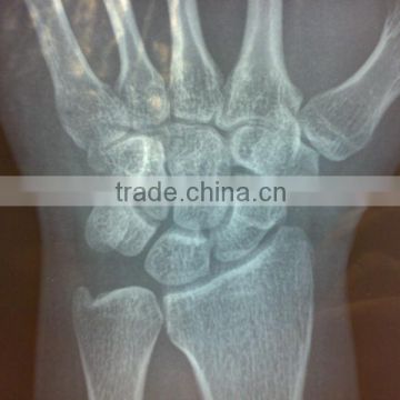 agfa /fuji x-ray equipments prices/medical clothing for china supplier
