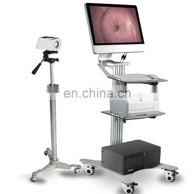 Advanced Camera digital video Portable mini vagina Gynecology handheld  colposcope Digital Optical colposcope