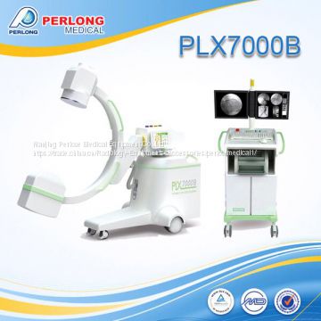 Carm machine portable X ray PLX7000B for DSA