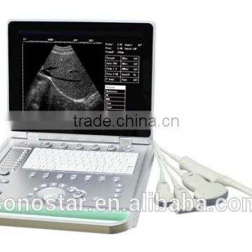 SS-7 Laptop Ultrasound Scanner(ultrasonic,black white,Imaging Sy