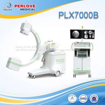 Medical equipment C-arm PLX7000B with CE