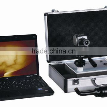 Infrared Mammary Diagnostic Equipment