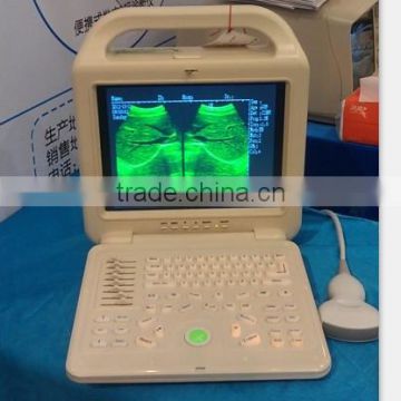 LCD Portable Pseudo Color US ultrasound scanner AJ-6100B
