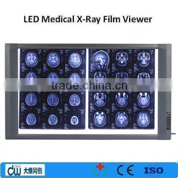 High illumination x ray image viewer/Led medical x-ray film viewer