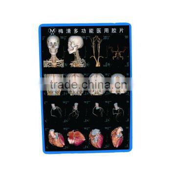 Meiqing Blue Base Medical Film\x-ray film\Fuji MDI-HLJ-C Substitute/Made in China