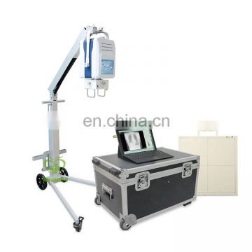 MY-D049R High technical Medical Mobile Digital Radiography system
