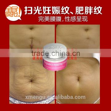 AFY Pregnancy Repairing Cream Beauty Personal Care Product 100g