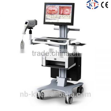 KT-2200I new type digital video colposcope with CE