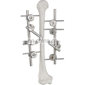 Quality Assured Orthopedic Surgical Instruments Humeral External Fixator Orthopedic Surgical Implant Surgery