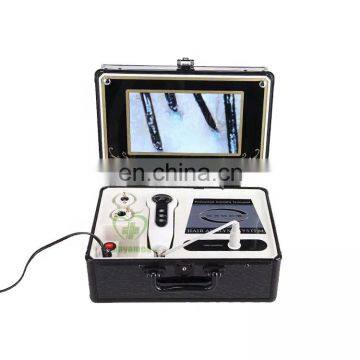 MY-S121 portable High Accurate skin and hair analyser