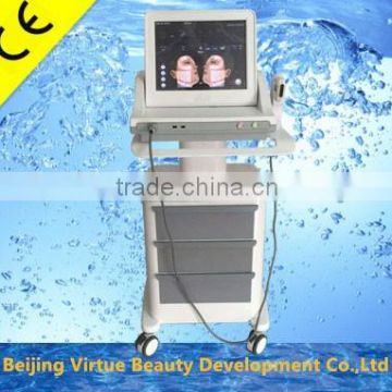 HIFU Machine 2016 Newest High Intensity Deep Wrinkle Removal Focused Ultrasound HIFU With Best Results Nasolabial Folds Removal