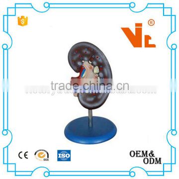 V-AM061 Best Price Medical Plastic Kidney Model