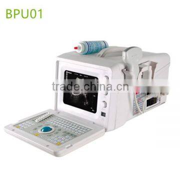 Portable hospital clinical ultrasound machine- BPU01