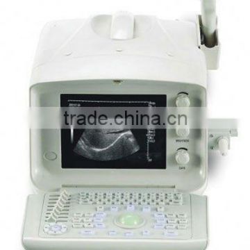 digital ultrasound scanner with ce
