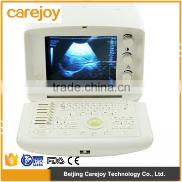Cheap price 2 probe connector digital ultrasound machine for scan