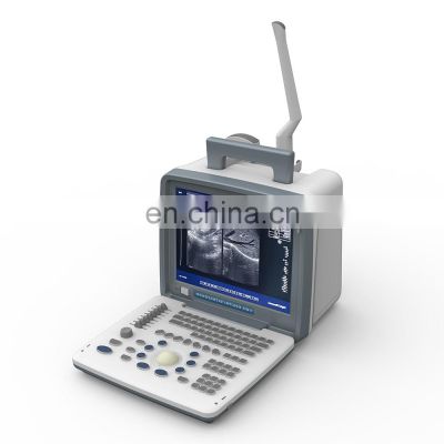 Wholesales Full digital LED Portable Black and White Ultrasound Machine for medical examination