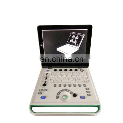 HC-A006B 15 inch Full digital Laptop pregnancy Ultrasound machine price (ARM based)