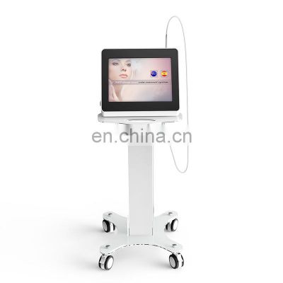 Portable 980Nm Diode Laser Face Red Blood Vessels Spider Vein Removal Machine For Legs