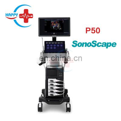 Factory price trolley color Ultrasound scanner/Sonoscape p50/portable color doppler ultrasound/Color doppler ultrasound machine