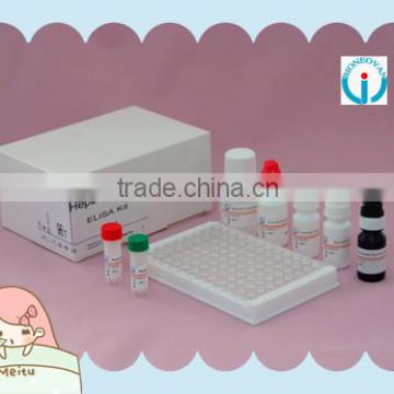 laboratory reagent Hepatitis C Virus test Antibody HCV ELISA test Kit