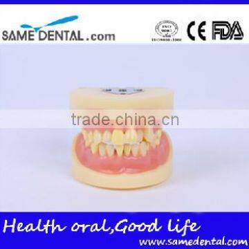 Dental Extraction Model School Teaching Model Teeth Model