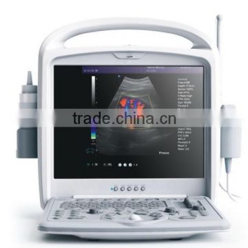 FM-9100T Good Price Full-digital Laptop Color Doppler System CE approved