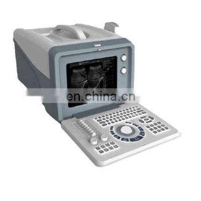 Best price Portable 10 inch medical ultrasound instruments B/W ultrasound machine for hospital and clinic