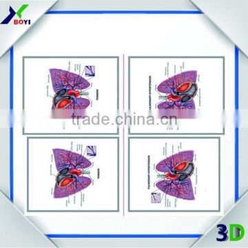 Custom high quality 3d embossed anatomical chart