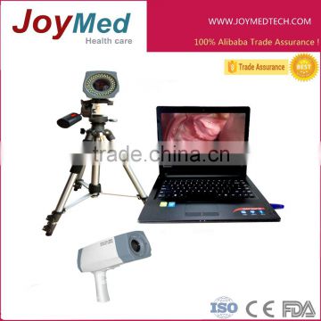 laptop digital video colposcope price/colposcopic imaging JM-5002