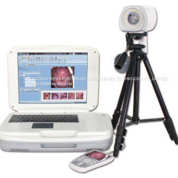 YKD-3004 Portable Digital Colposcope