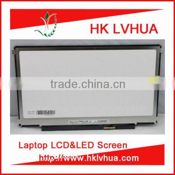 17.3 laptop screen replacement IPS PANEL resolution of 1080 x 1920 pixels edp 30PIN display LP173WF4-SPD1