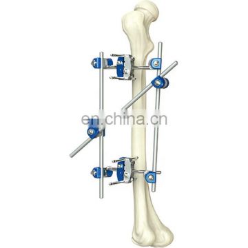 Guaranteed Quality Tibia & Percone External Fixator for Orthopedic External Fixation Surgical Instruments