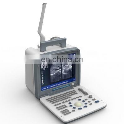 best price  scanner  handheld medical portable laptop black and white ultrasound