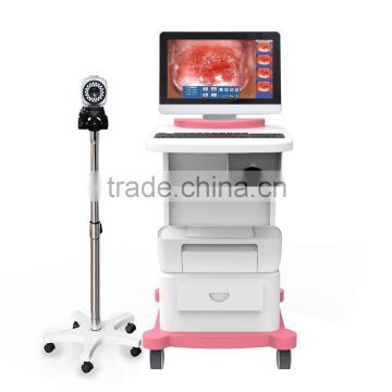 ce approved Digital electronic colposcope with new design