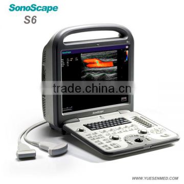 Vet color doppler echocardiography portable sonoscape s6v
