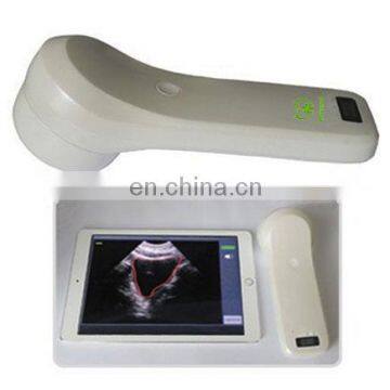 High Quality MY-A010F 4D wireless probe bladder scanner for sale