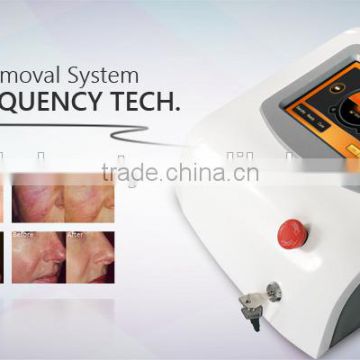2015 newest whole sale laser portable spider vein removal machine RBS 6601