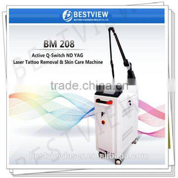 nd yag laser tattoo removal with best sooling system