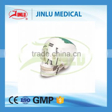 JINLU High quality titanium material Z-shaped plate(L/R type),implant bone plate,maxillo-facial bone plates.