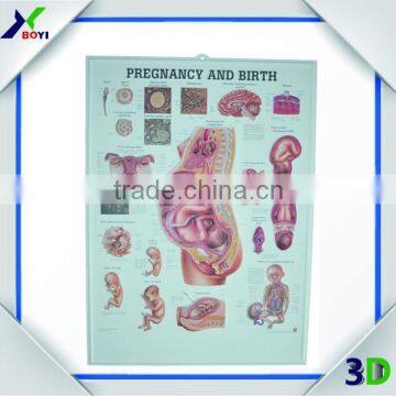 embossed pvc 3d medical poster/anatomical chart (pregnancy)