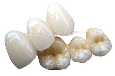 PFM Ceramic Dental Bridge Custom Colour Stability