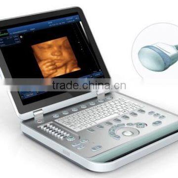 MCB-SS-10Plus Laptop 4D B/W Ultrasound Machine
